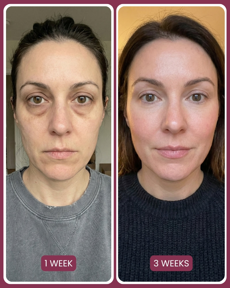 PDRN Pink Collagen Volume Multi Balm