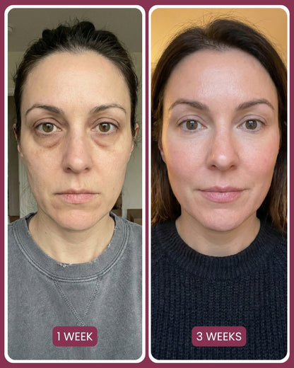 PDRN Pink Collagen Volume Multi Balm