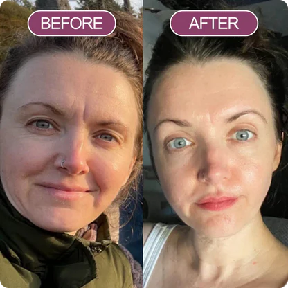 before_after_balm_2_1.webp