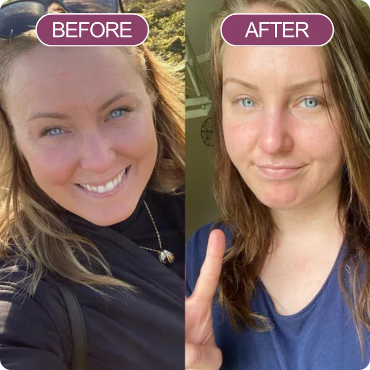 before_after_balm_3_3.webp