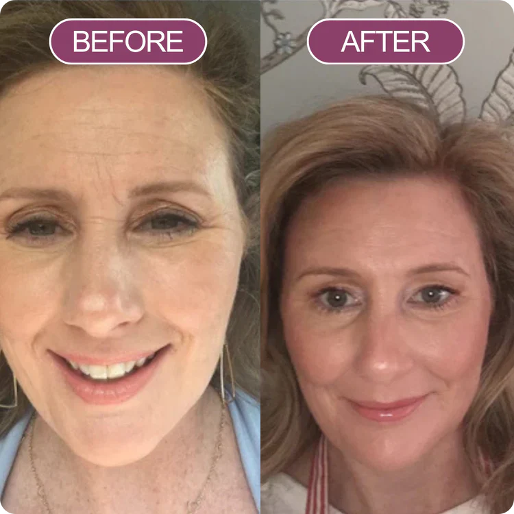 beforeafterbalm1_3.webp